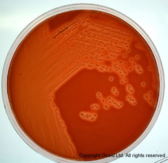 Oxoid 马血清SR0035C 裂解马血SR0048C 脱纤维马血SR0050 脱纤维羊血SR0051B RPF添加剂 SR0122A